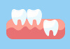 歯並びの画像